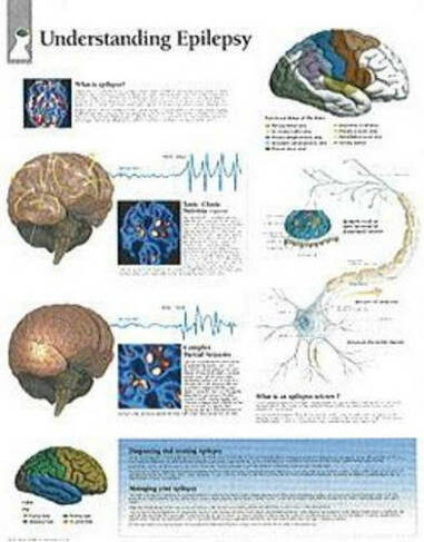 Understanding Epilepsy Laminated Poster | WHSmith